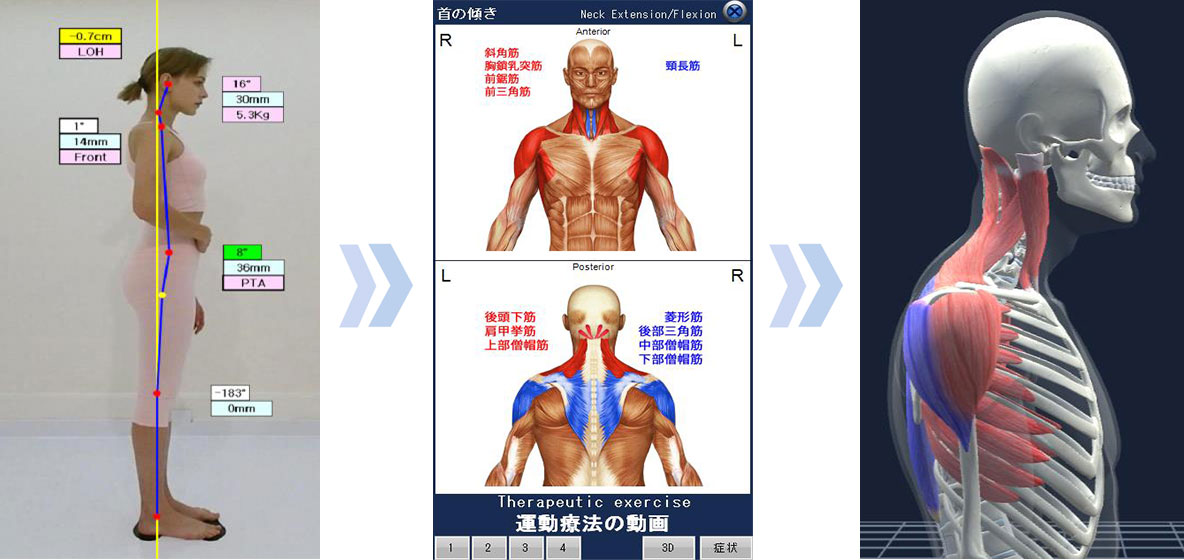 体格測定器 exbody