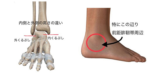 足関節 足首 の捻挫について The解説 栃木県壬生町の整骨院 疋田整骨院
